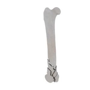 Femur - Feline - Fracture 33-C2 acc. to AOVet