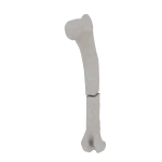 Humerus - Feline - Fracture 12-A3 acc. to AOVet