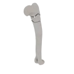 Humerus - Feline - Fracture 11-B1 acc. to AOVet