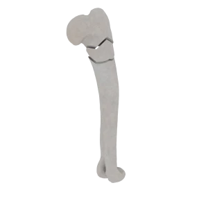 Humerus - Feline - Fracture 11-B1 acc. to AOVet