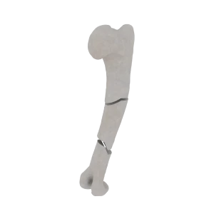 Humerus - Feline - Fracture 12-C2 acc. to AOVet 
