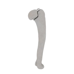 Humerus - Feline - Fracture 11-C1 acc. to AOVet