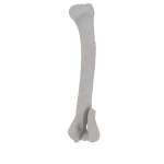 Humerus - Feline - Fracture 13-B2 acc. to AOVet