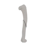 Humerus - Feline - Fracture 12-A2 acc. to AOVet