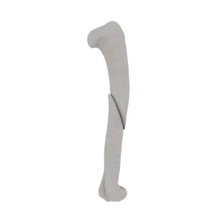 Humerus - Feline - Fracture 12-A2 acc. to AOVet