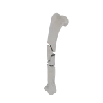 Humerus - Feline - Fracture 12-C1 acc. to AOVet