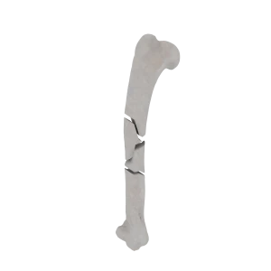 Humerus - Feline - Fracture 12-C1 acc. to AOVet