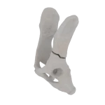 Pelvis - Feline - Ilial Body Fracture