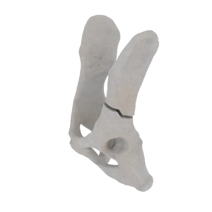 Pelvis - Feline - Ilial Body Fracture