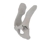 Pelvis - Feline - Acetabular Fracture I
