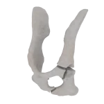 Pelvis - Feline - Acetabular Fracture (T-shape)