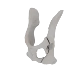 Pelvis - Feline - Oblique fracture through the cranial part of the body of the ilium and acetabulum