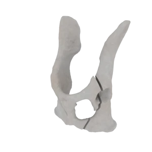 Pelvis - Feline - Oblique fracture through the cranial part of the body of the ilium and acetabulum