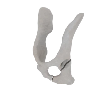 Pelvis - Feline - Oblique fracture through the caudal part of the body of the ischium and acetabulum