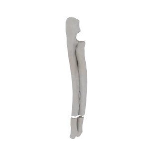 Radius and Ulna - Feline - Fracture 22-A2 acc. to AOVet 