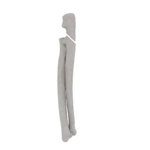 Radius and Ulna - Feline - Fracture 21-B1 acc. to AOVet