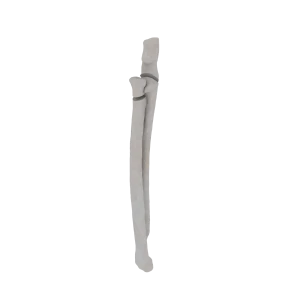 Radius and Ulna - Feline - Fracture 21-B3 acc. to AOVet