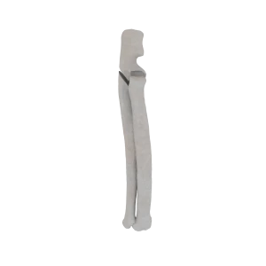 Radius and Ulna - Feline - Fracture 21-A1 acc. to AOVet 