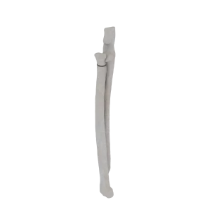 Radius and Ulna - Feline - Fracture 21-A2 acc. to AOVet 
