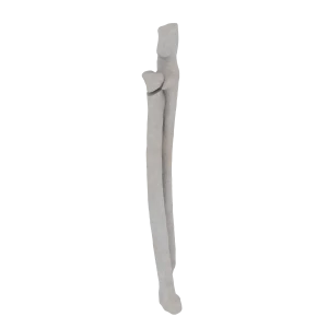 Radius and Ulna - Feline - Fracture 21-B2 acc. to AOVet 