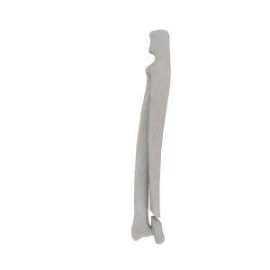 Radius and Ulna - Feline - Fracture 23-A1 acc. to AOVet