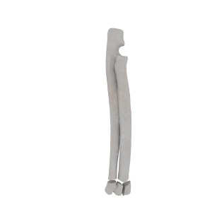 Radius and Ulna - Feline - Fracture 23-C1 acc. to AOVet 
