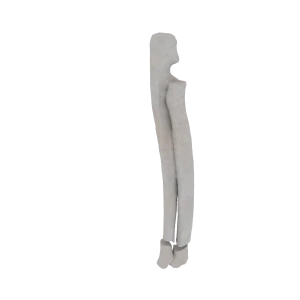 Radius and Ulna - Feline - Fracture 23-A2 acc. to AOVet