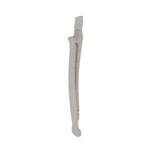 Radius and Ulna - Feline - Fracture 22-A1-Ulnar acc. to AOVet  