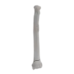 Radius - Canine - Fracture 23-A2 acc. to AOVet