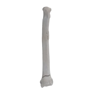 Radius - Canine - Fracture 23-A2 acc. to AOVet