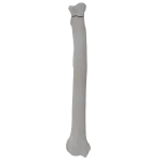 Radius - Canine - Fracture 21-A2 acc. to AOVet