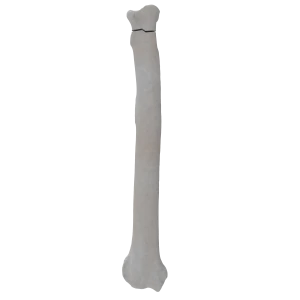 Radius - Canine - Fracture 21-A2 acc. to AOVet