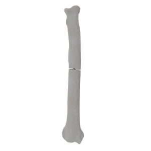 Radius - Canine - Fracture I 22-A1 acc. to AOVet