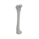 Femur - Canine - Fracture I 31-B3 acc. to AOVet