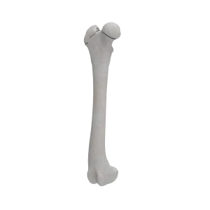 Femur - Canine - Fracture I 31-B3 acc. to AOVet