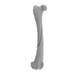 Femur - Canine - Fracture 32-A2 acc. to AOVet