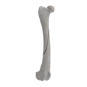 Femur - Canine - Fracture 32-A2 acc. to AOVet
