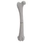 Femur - Canine - Fracture 32-A3 acc. to AOVet