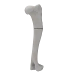 Humerus - Canine - Fracture I 12-A3 acc. to AOVet