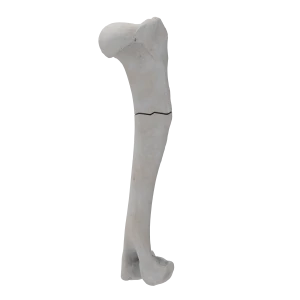 Humerus - Canine - Fracture I 12-A3 acc. to AOVet
