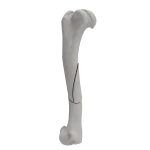 Humerus - Canine - Fracture 12-B1 acc. to AOVet