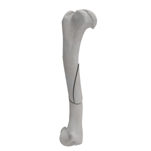 Humerus - Canine - Fracture 12-B1 acc. to AOVet