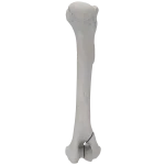 Humerus - Canine - Fracture 13-B1 acc. to AOVet